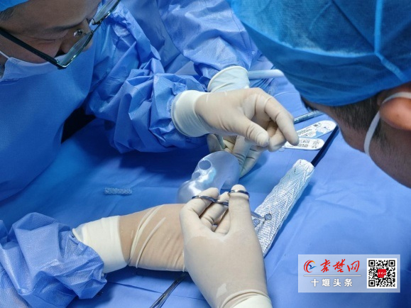 3D打印技術(shù)助力復(fù)雜手術(shù)，十堰人醫(yī)為89歲高齡患者拆除動(dòng)脈瘤