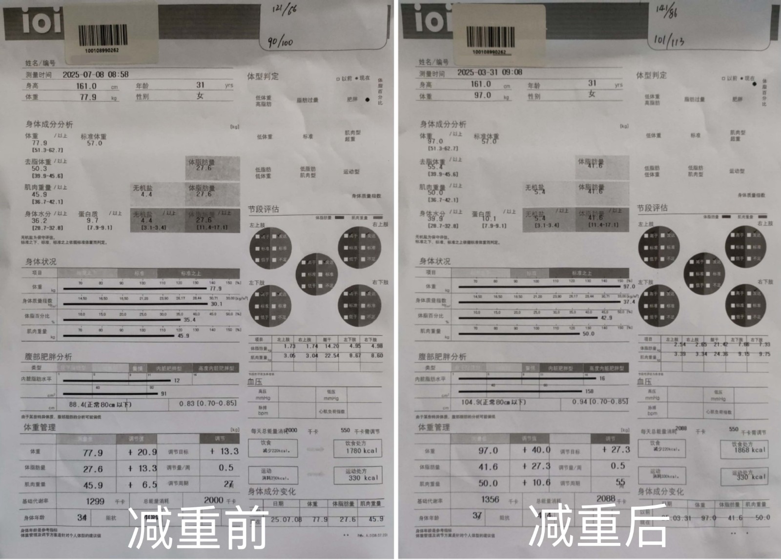 女子科學(xué)共管減重19公斤，逆轉(zhuǎn)代謝危機(jī)