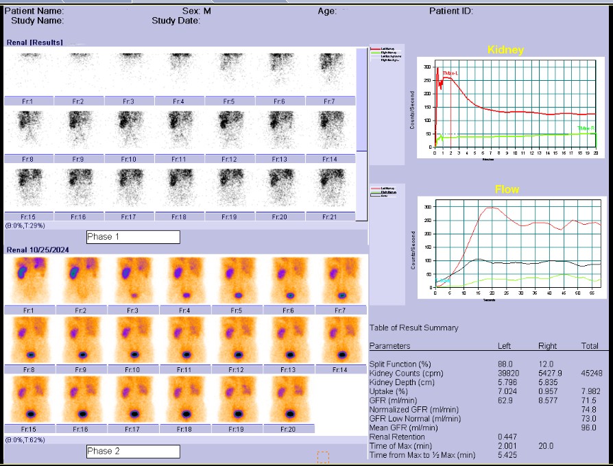 腎動態(tài)顯像檢查流程及注意事項